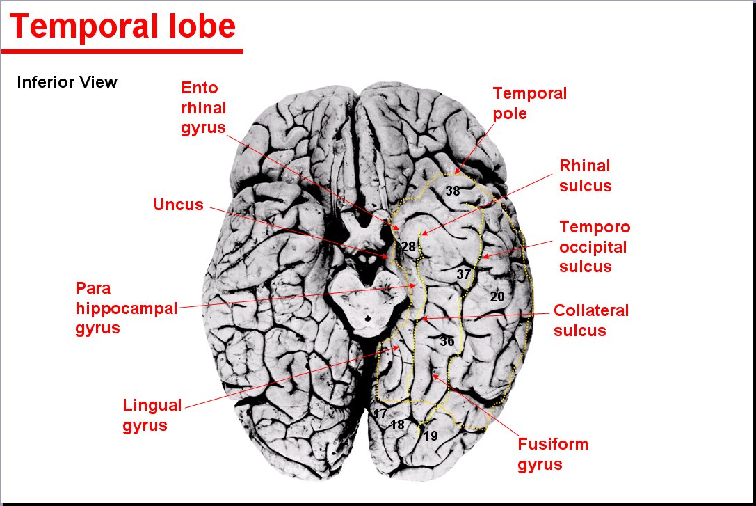 Salamons Neuroanatomy And Neurovasculature Web Atlas Resource